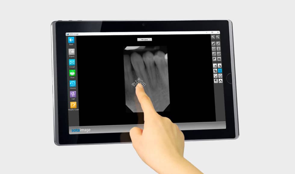 Clio Digital XRay Sensor SOTA Imaging