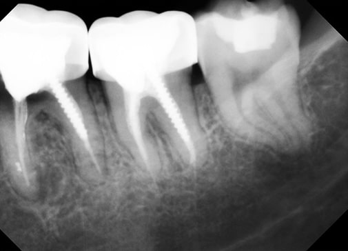 X-Ray X-Ray