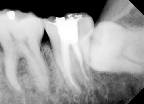 X-Ray X-Ray